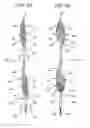 Fig. 11 - Embolic protection during percutaneous heart valve replacement and similar procedures
