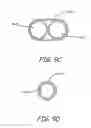 Fig. 12 - Embolic protection during percutaneous heart valve replacement and similar procedures