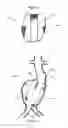 Fig. 03 - Aneurysm Graft With Stabilization
