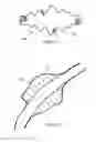 Fig. 10 - Aneurysm Graft With Stabilization