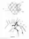 Fig. 16 - Aneurysm Graft With Stabilization