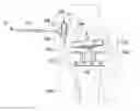 Fig. 01 - System and method for load balancing in knee replacement procedures