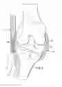 Fig. 03 - System and method for load balancing in knee replacement procedures