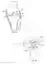 Fig. 05 - System and method for load balancing in knee replacement procedures