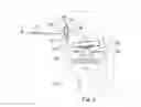 Fig. 07 - System and method for load balancing in knee replacement procedures