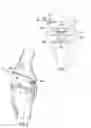 Fig. 08 - System and method for load balancing in knee replacement procedures