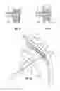 Fig. 02 - Medical device delivery system and method