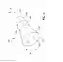 Fig. 05 - Tissue capturing bone anchor