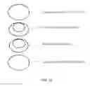 Fig. 15 - Piezoelectric sensor for vision correction