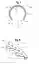 Fig. 04 - Surgical Apparatus and Method Of Implanting The Same