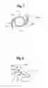 Fig. 05 - Surgical Apparatus and Method Of Implanting The Same