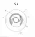 Fig. 06 - Surgical Apparatus and Method Of Implanting The Same