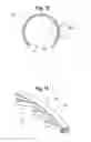 Fig. 07 - Surgical Apparatus and Method Of Implanting The Same