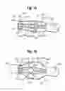 Fig. 09 - Expandable member for deploying a prosthetic device