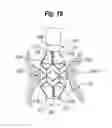 Fig. 10 - Expandable member for deploying a prosthetic device