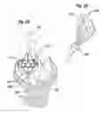 Fig. 13 - Expandable member for deploying a prosthetic device