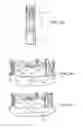 Fig. 03 - Means for Controlled Sealing of Endovascular Devices