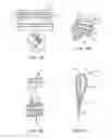 Fig. 05 - Means for Controlled Sealing of Endovascular Devices