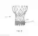 Fig. 11 - Means for Controlled Sealing of Endovascular Devices
