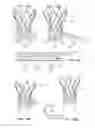 Fig. 13 - Means for Controlled Sealing of Endovascular Devices