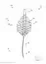 Fig. 02 - Apparatus, system, and method for treating a regurgitant heart valve