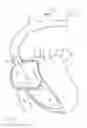 Fig. 09 - Apparatus, system, and method for treating a regurgitant heart valve