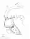 Fig. 13 - Apparatus, system, and method for treating a regurgitant heart valve