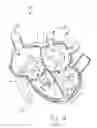 Fig. 14 - Apparatus, system, and method for treating a regurgitant heart valve