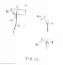 Fig. 08 - Transcatheter Stent-Valves and Methods, Systems and Devices for Addressing Para-Valve Leakage