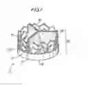 Fig. 02 - Prosthetic heart valve and method