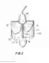 Fig. 03 - Prosthetic heart valve and method