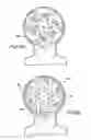 Fig. 21 - Prosthetic heart valve and method