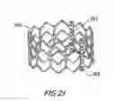 Fig. 24 - Prosthetic heart valve and method