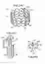 Fig. 27 - Prosthetic heart valve and method
