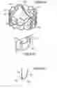 Fig. 45 - Prosthetic heart valve and method