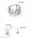 Fig. 50 - Prosthetic heart valve and method