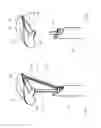 Fig. 16 - Implant and method for improving coaptation of an atrioventricular valve