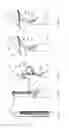 Fig. 18 - Implant and method for improving coaptation of an atrioventricular valve