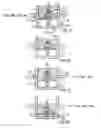 Fig. 03 - Penile prosthesis