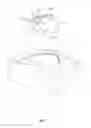 Fig. 03 - PROSTHETIC COMPONENT WITH CROSSLINKED POLYMER WEAR ZONE AND EDGE PROTECTION