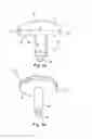 Fig. 04 - System of designing a guide tool and/ or surgical kit tools and/or an implant comprising a positioning mark