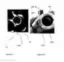 Fig. 05 - System of designing a guide tool and/ or surgical kit tools and/or an implant comprising a positioning mark