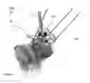 Fig. 08 - System of designing a guide tool and/ or surgical kit tools and/or an implant comprising a positioning mark