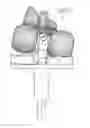 Fig. 01 - Implant with multi-directional pivoting