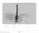 Fig. 08 - Method of implanting a unicondylar knee prosthesis