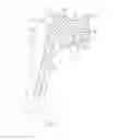 Fig. 02 - Shoulder prosthesis with variable inclination humeral head component