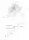 Fig. 03 - Shoulder prosthesis with variable inclination humeral head component
