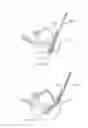 Fig. 32 - Interbody implants and graft delivery systems