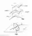 Fig. 02 - Articulating disc implant