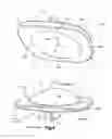 Fig. 04 - Articulating disc implant
